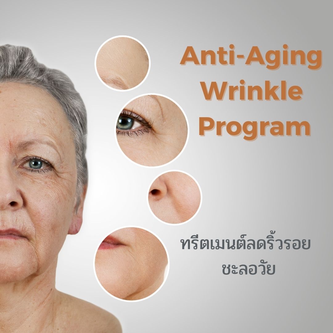 Anti Aging Wrinkle Program ลดริ้วรอย Phimphika Clinic